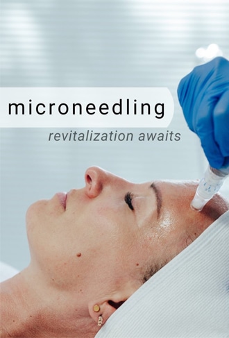Microneedling in Bellevue, WA