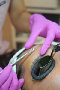 client dermaplane 2