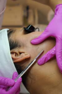 client dermaplane 6