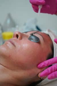 laser treatment 13