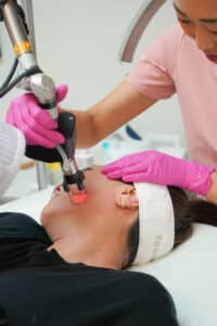 laser treatment 27