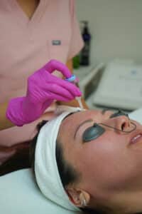 laser treatment 5